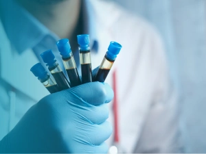 Déficit en G6PD : symptômes, causes et diagnostic